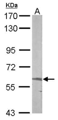 Western Blot: ALAS2 Antibody [NBP1-32826]