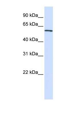 Western Blot: ALAS2 Antibody [NBP1-54697]