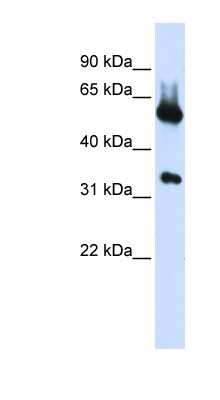 Western Blot: ALAS2 Antibody [NBP1-54726]