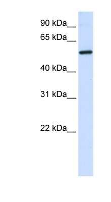 Western Blot: ALAS2 Antibody [NBP1-54727]