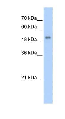 Western Blot: ALAS2 Antibody [NBP1-54728]