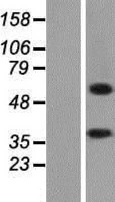 Western Blot: ALAS2 Overexpression Lysate [NBP2-08559]