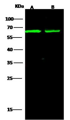 Western Blot: ALCAM/CD166 Antibody (008) [NBP2-90954]