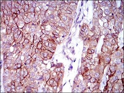 Immunohistochemistry-Paraffin: ALCAM/CD166 Antibody (4H9A5) - BSA Free [NBP2-37345]