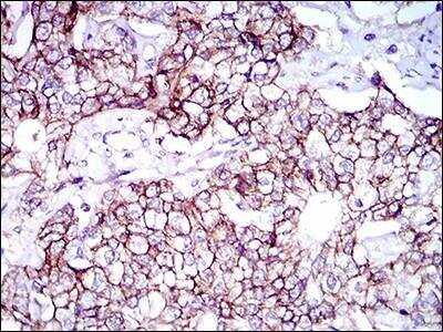 Immunohistochemistry-Paraffin: ALCAM/CD166 Antibody (4H9A5) - BSA Free [NBP2-37345]