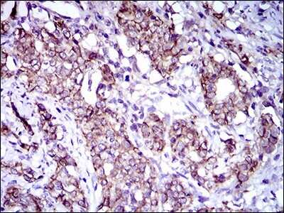 Immunohistochemistry: ALCAM/CD166 Antibody (8E12C7) - BSA Free [NBP2-37358]