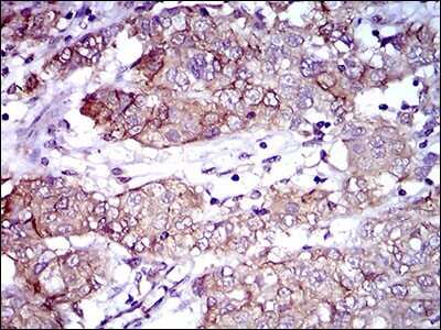 Immunohistochemistry: ALCAM/CD166 Antibody (8E12C7) - BSA Free [NBP2-37358]