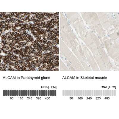 Immunohistochemistry-Paraffin: ALCAM/CD166 Antibody [NBP1-88129]