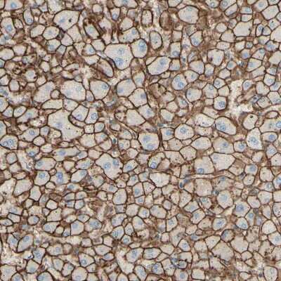 Immunohistochemistry-Paraffin: ALCAM/CD166 Antibody [NBP1-88129]