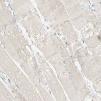 Immunohistochemistry-Paraffin: ALCAM/CD166 Antibody [NBP1-88129]