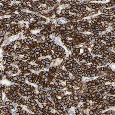 Immunohistochemistry-Paraffin: ALCAM/CD166 Antibody [NBP1-88129]