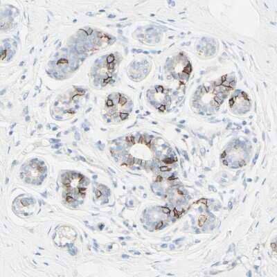 Immunohistochemistry-Paraffin: ALCAM/CD166 Antibody [NBP1-88129]