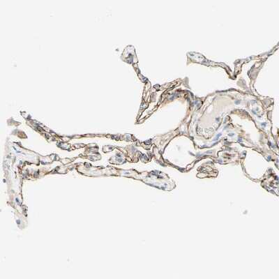 Immunohistochemistry-Paraffin: ALCAM/CD166 Antibody [NBP1-88129]