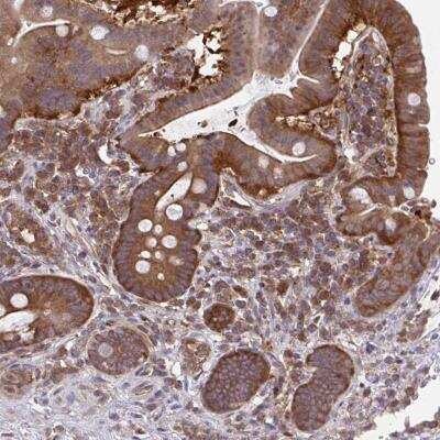 Immunohistochemistry-Paraffin: ALDH16A1 Antibody [NBP2-31774]