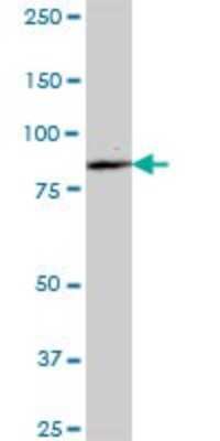 Western Blot: ALDH16A1 Antibody [H00126133-B01P]