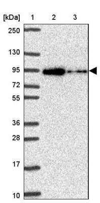 Western Blot: ALDH16A1 Antibody [NBP2-31774]