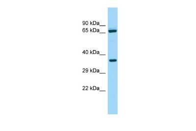 Western Blot: ALDH16A1 Antibody [NBP2-86974]