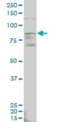 Western Blot: ALDH18A1 Antibody (2B5) [H00005832-M01]