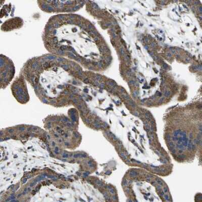 Immunohistochemistry-Paraffin: ALDH18A1 Antibody [NBP1-83324]