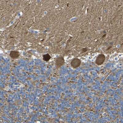 Immunohistochemistry-Paraffin: ALDH18A1 Antibody [NBP1-83324]