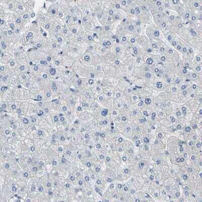 Immunohistochemistry-Paraffin: ALDH18A1 Antibody [NBP1-83324]