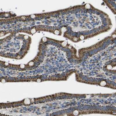Immunohistochemistry-Paraffin: ALDH18A1 Antibody [NBP1-83324]