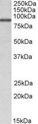 Western Blot: ALDH18A1 Antibody [NBP1-52098]