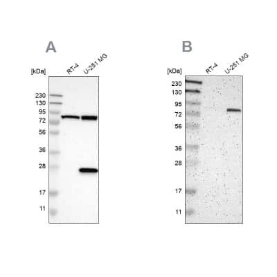 Western Blot: ALDH18A1 Antibody [NBP1-83324]