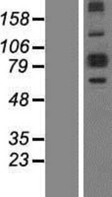 Western Blot: ALDH18A1 Overexpression Lysate [NBP2-08064]