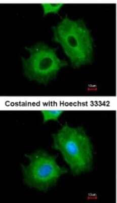 Immunocytochemistry/ Immunofluorescence: Aldehyde Dehydrogenase 1-A1/ALDH1A1 Antibody [NBP2-15336]