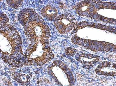 Immunohistochemistry-Paraffin: Aldehyde Dehydrogenase 1-A1/ALDH1A1 Antibody [NBP2-15336]