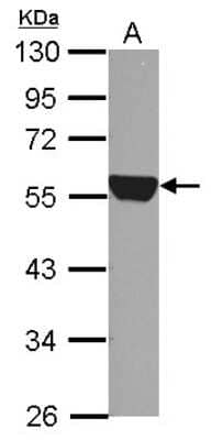 Western Blot: Aldehyde Dehydrogenase 1-A1/ALDH1A1 Antibody [NBP2-15334]