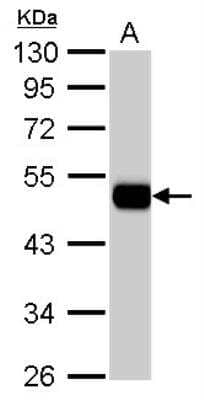 Western Blot: Aldehyde Dehydrogenase 1-A1/ALDH1A1 Antibody [NBP2-15336]