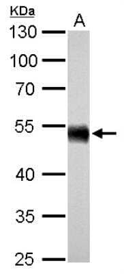 Western Blot: Aldehyde Dehydrogenase 1-A1/ALDH1A1 Antibody [NBP2-15336]