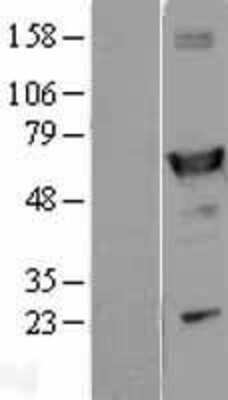 Western Blot: Aldehyde Dehydrogenase 1-A1/ALDH1A1 Overexpression Lysate [NBL1-07451]