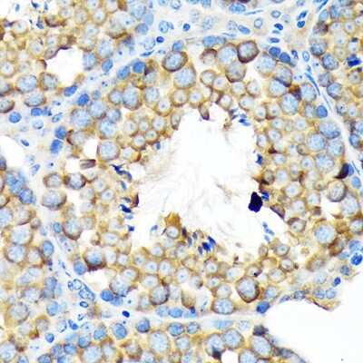 Immunohistochemistry-Paraffin: ALDH1A2 Antibody (3D2P3) [NBP3-16755]