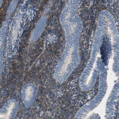 Immunohistochemistry-Paraffin: ALDH1A2 Antibody [NBP1-87158]