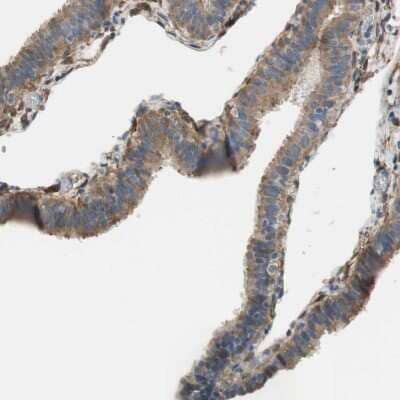 Immunohistochemistry-Paraffin: ALDH1A2 Antibody [NBP1-87158]