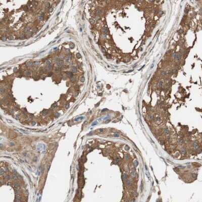 Immunohistochemistry-Paraffin: ALDH1A2 Antibody [NBP1-87158]