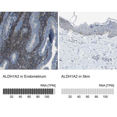 Immunohistochemistry-Paraffin: ALDH1A2 Antibody [NBP1-87158]