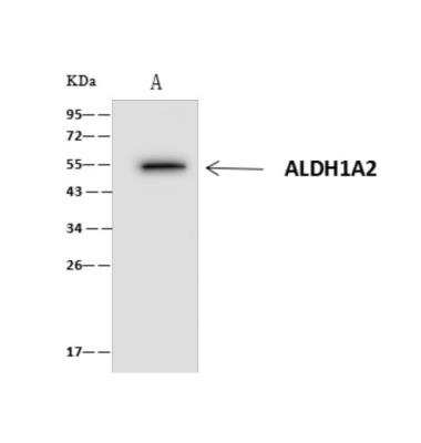 Immunoprecipitation: ALDH1A2 Antibody [NBP3-06323]