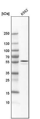 Western Blot: ALDH1A2 Antibody [NBP1-87158]