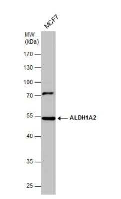 Western Blot: ALDH1A2 Antibody [NBP2-15338]