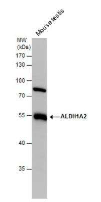 Western Blot: ALDH1A2 Antibody [NBP2-15338]
