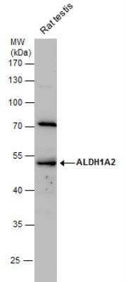 Western Blot: ALDH1A2 Antibody [NBP2-15338]