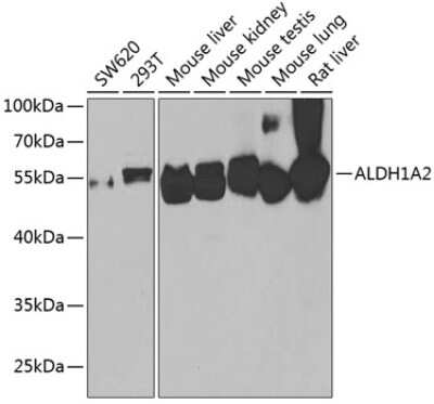 Western Blot: ALDH1A2 AntibodyBSA Free [NBP2-92915]