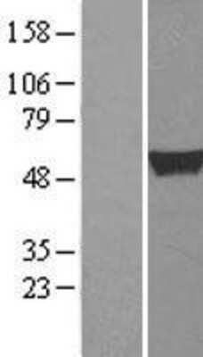 Western Blot: ALDH1A2 Overexpression Lysate [NBL1-07452]