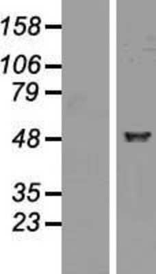 Western Blot: ALDH1A2 Overexpression Lysate [NBP2-10014]