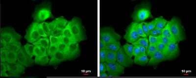 Immunocytochemistry/ Immunofluorescence: ALDH1A3 Antibody - BSA Free [NBP2-15339]