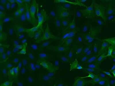 Immunocytochemistry/ Immunofluorescence: ALDH1A3 Antibody - BSA Free [NBP2-15339]